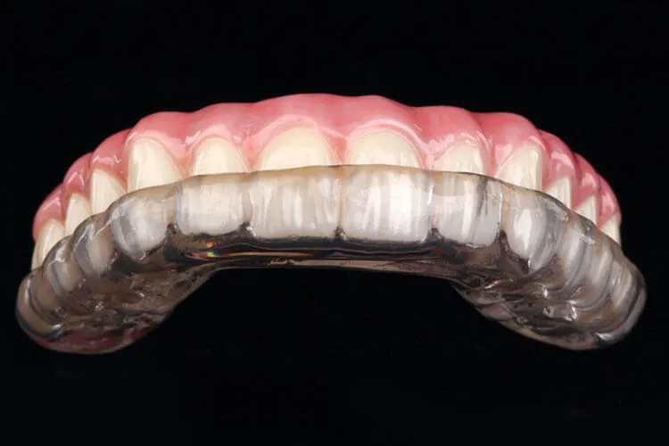 Headache and TMJ Disorder, Park St Dental, Dr Neda Gorji and Associates, Teeth Clenching, Teeth grinding, splint, Northern Beaches, Mona Vale Best Dentist