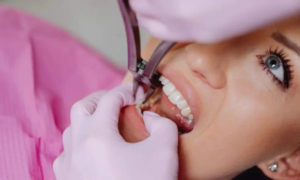 Dental Implant Maintenance