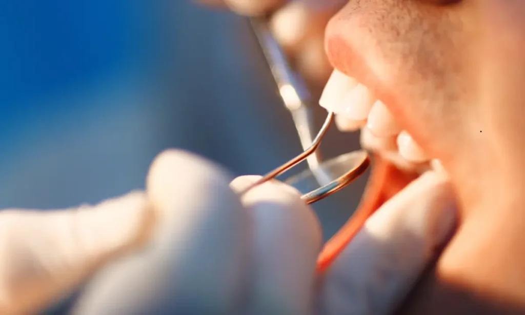 Emergency Dental Bridge Repair