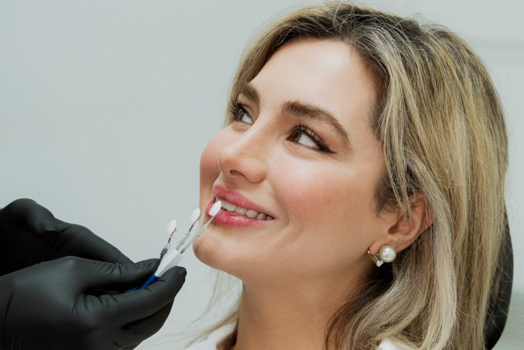 Dental Veneers in Mona Vale, Dental veneer covering the front surface of a tooth,Best veneers in Sydney, Best Veneers in Northern Beaches, Best Cosmetic Dentist Near Me, Park St Dental Practice, Mona Vale Dentist, Dr Neda Gorji and Associatesntal Practice, Dr Neda Gorji & Associates, Mona Vale Best Cosmetic Dentist, Crown, Straight teeth, Northern Beaches Cosmetic Dentist, Smile Makeover, porcelain veneers, smile Design in Mona Vale