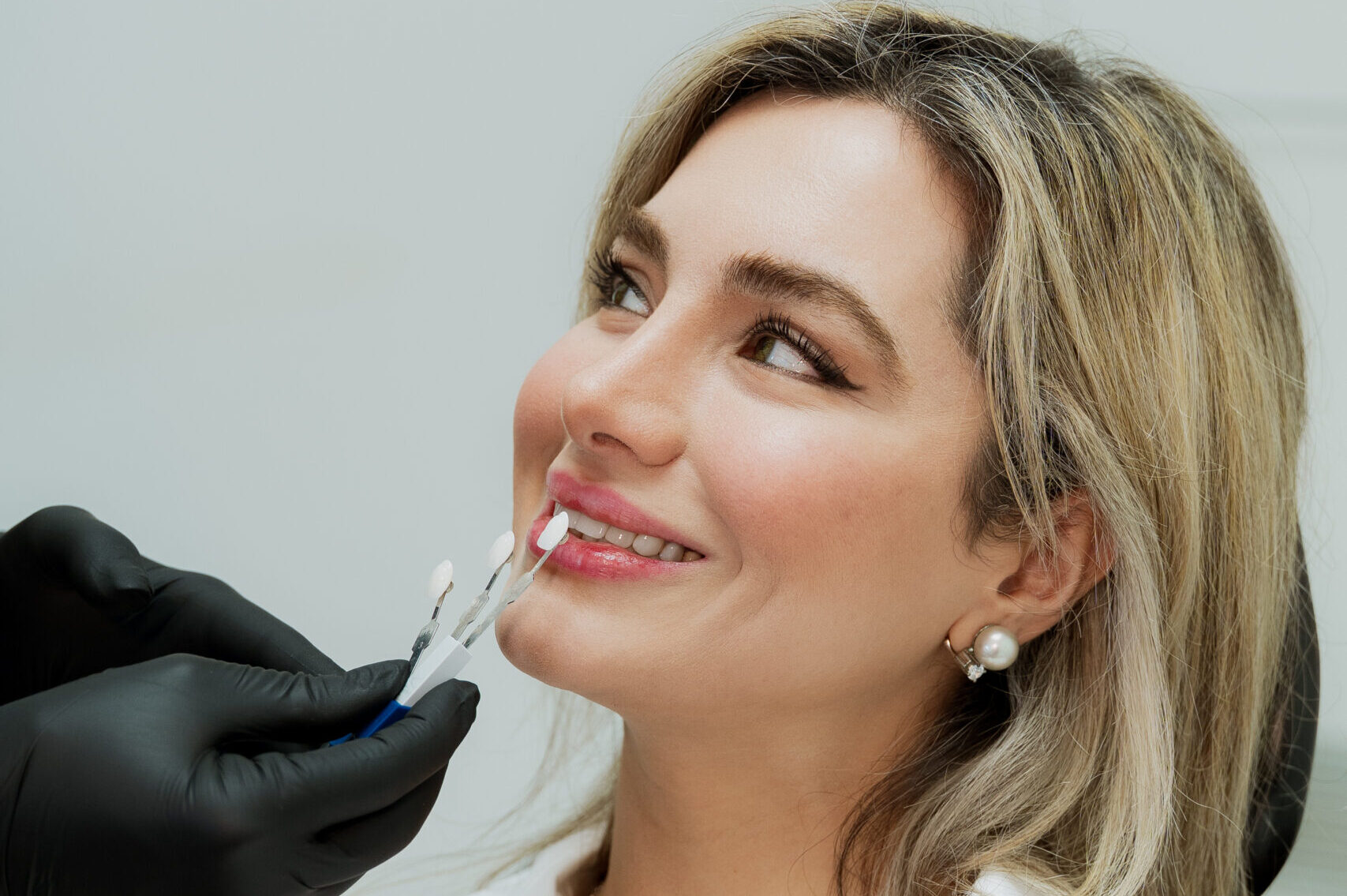 Crown and Bridges in Mona Vale, Park St Dental Practice, Damaged Teeth